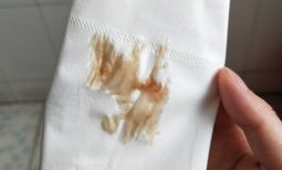 什么是褐色分泌物,“褐色分泌物的成因与应对策略解析”
